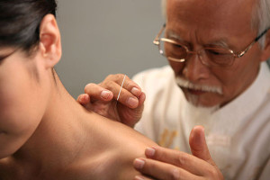 Acupuncture